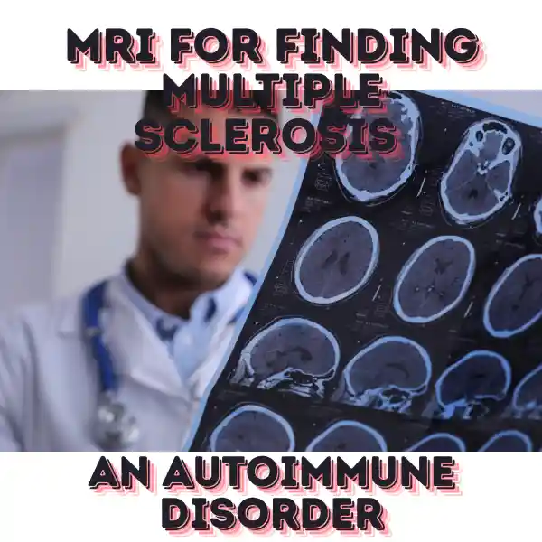 autoimmune disorder finding through MRI