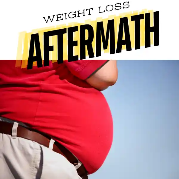 WEIGHT LOSS AFTERMATH IS WRITTEN WITH PIC OF FAT MAN