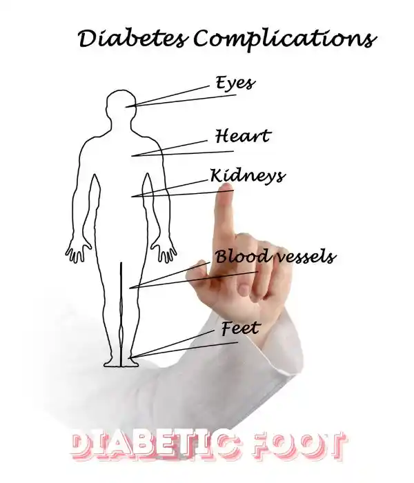 diabetic foot and other complications 