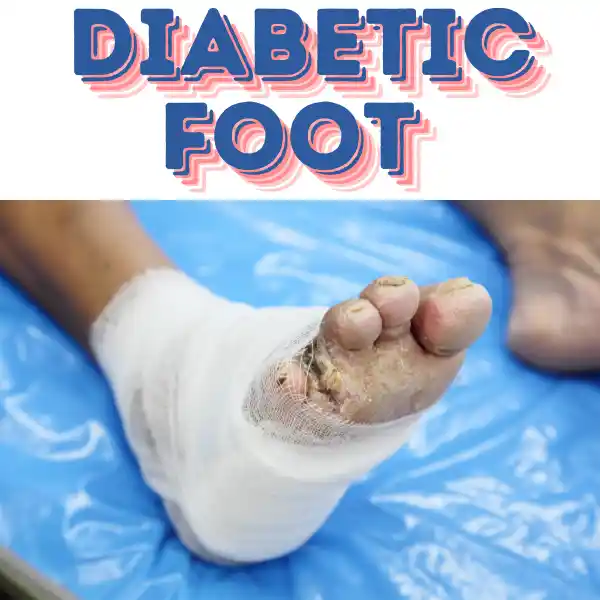 diabetic foot is written with picture